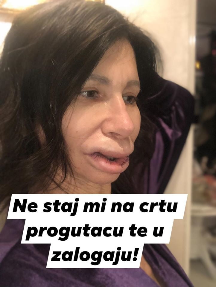 Jel jebao neko Elenu (Snezu D.) Iskustva? #80108203