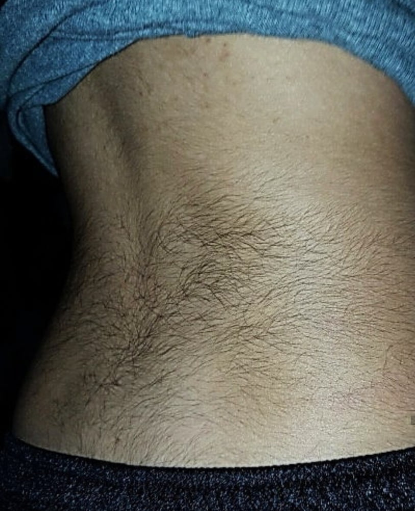 just hairy for you #95182560