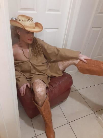 Skinny Vitiligo Oma
 #88554126