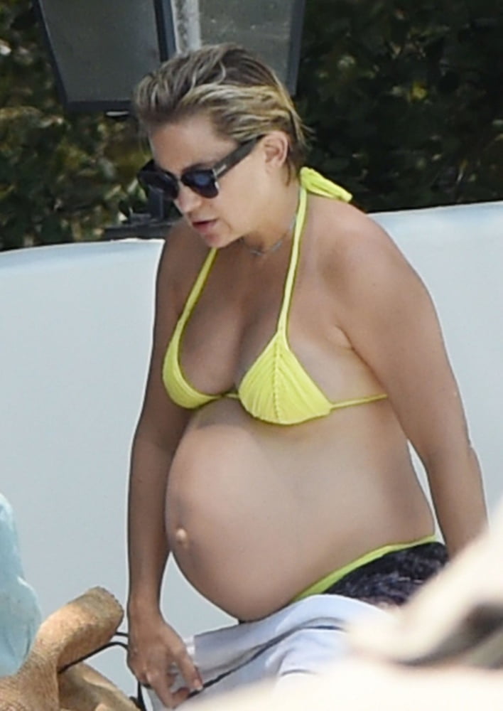 Kate Hudson
 #98826404