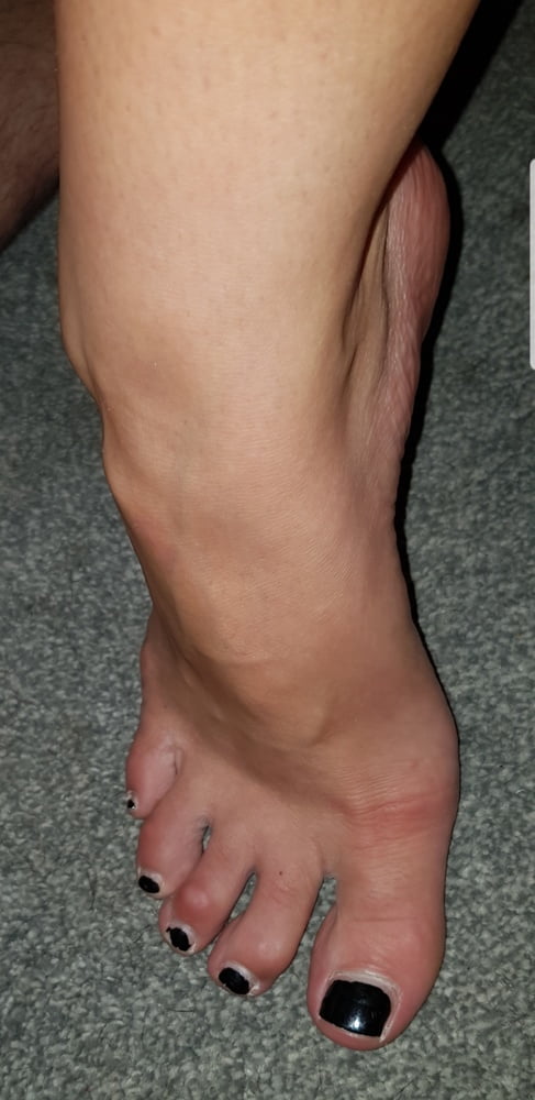 Gf feet #80194996