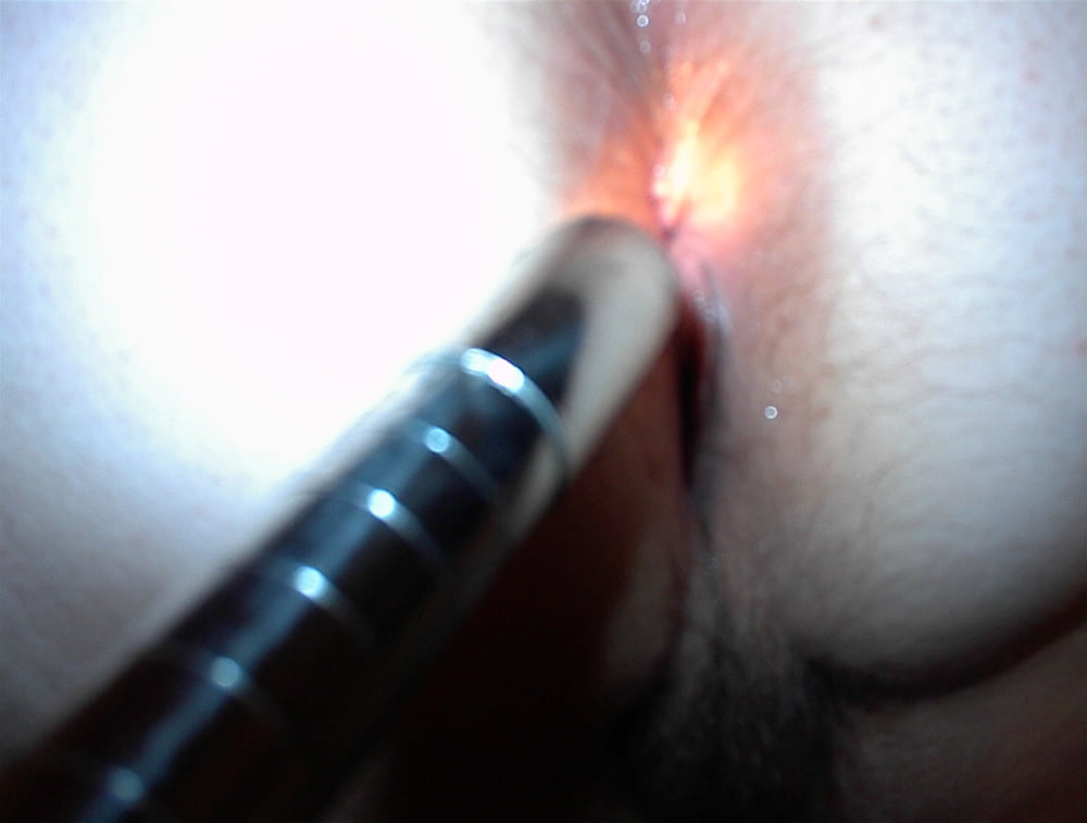 Enema and Scope #98730745