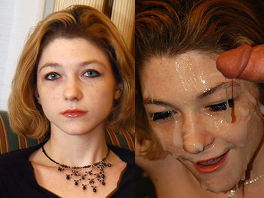 Before and After Gallery #92988543