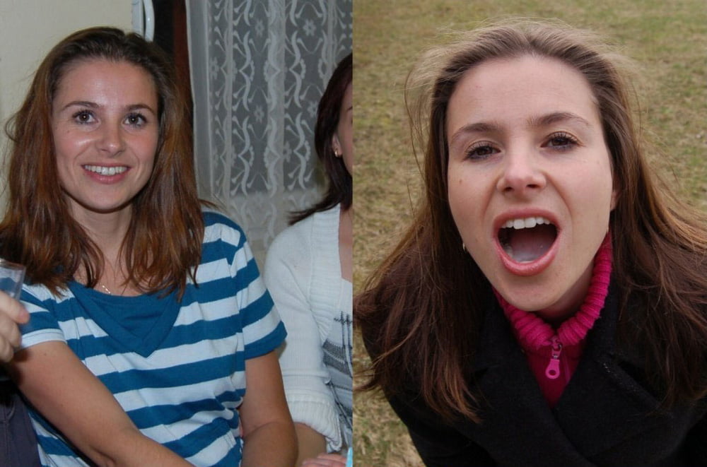 Before and After Gallery #92988558