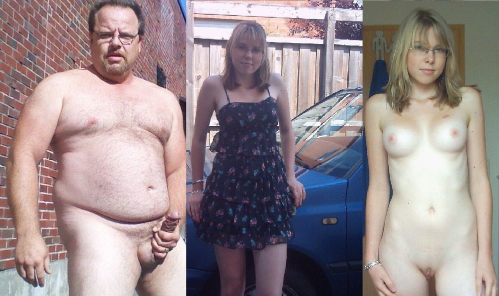 Before and After Gallery #92988595