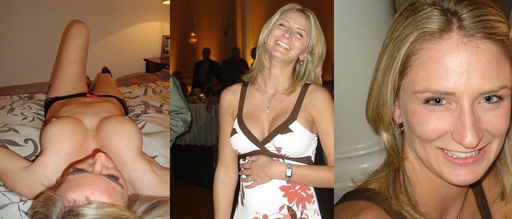 Before and After Gallery #92988610