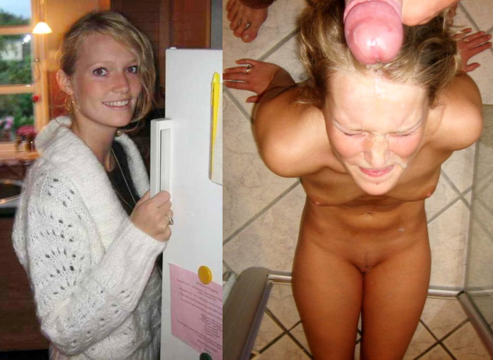 Before and After Gallery #92988623