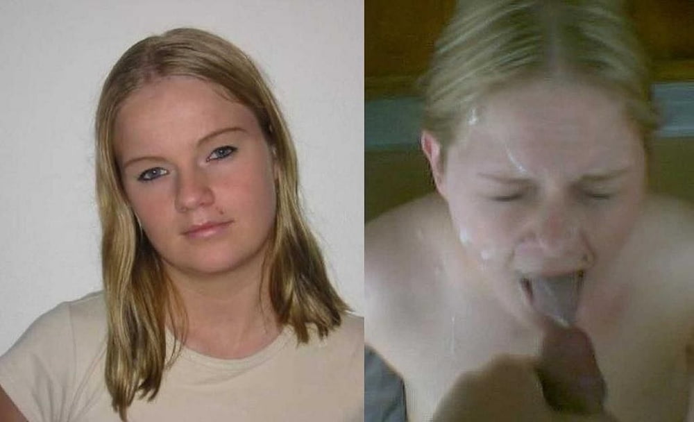 Before and After Gallery #92988625