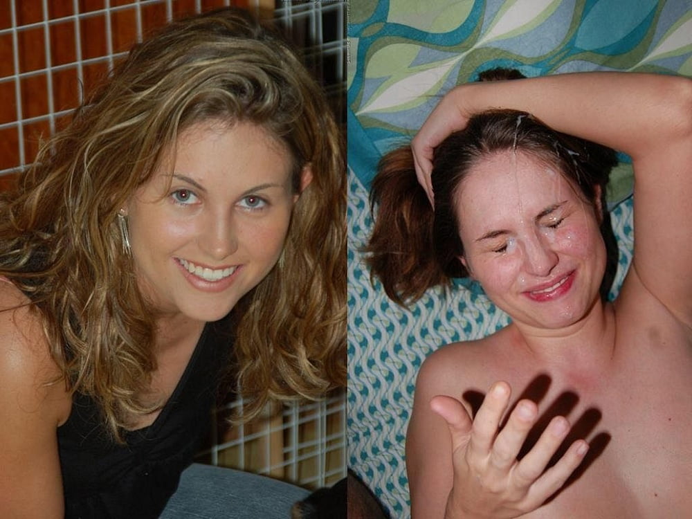 Before and After Gallery #92988628