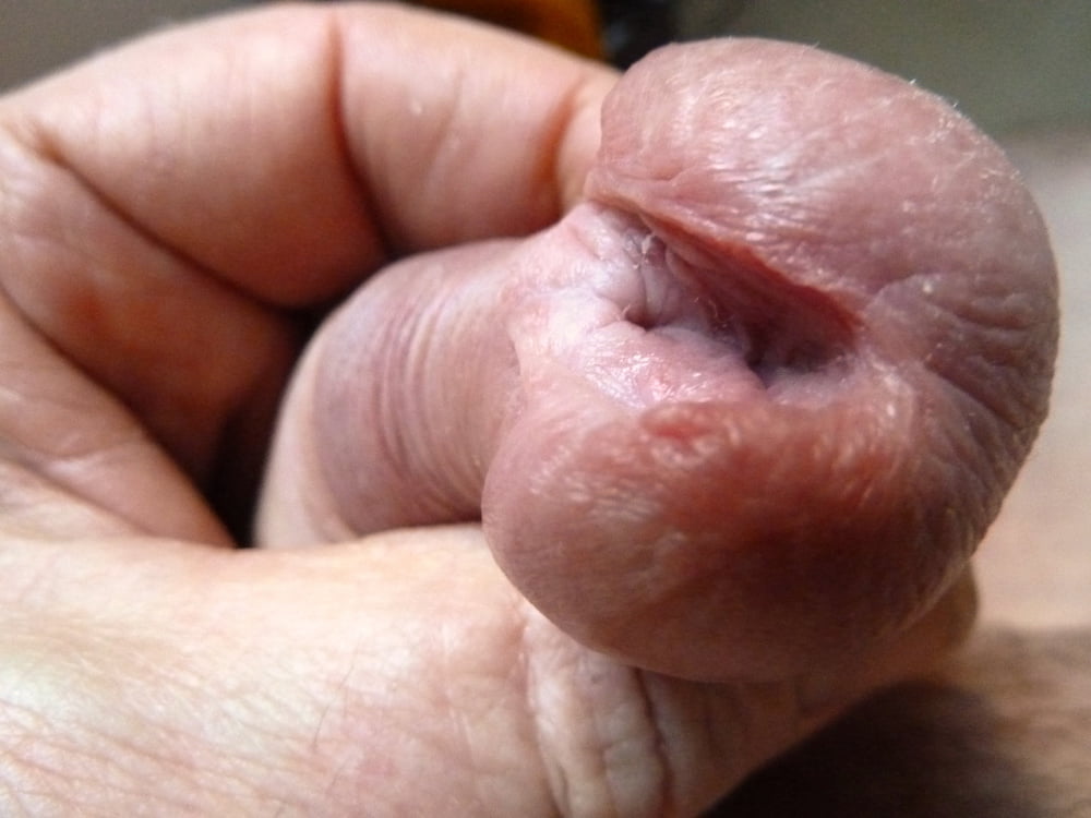 from a small to a big peehole #107224776