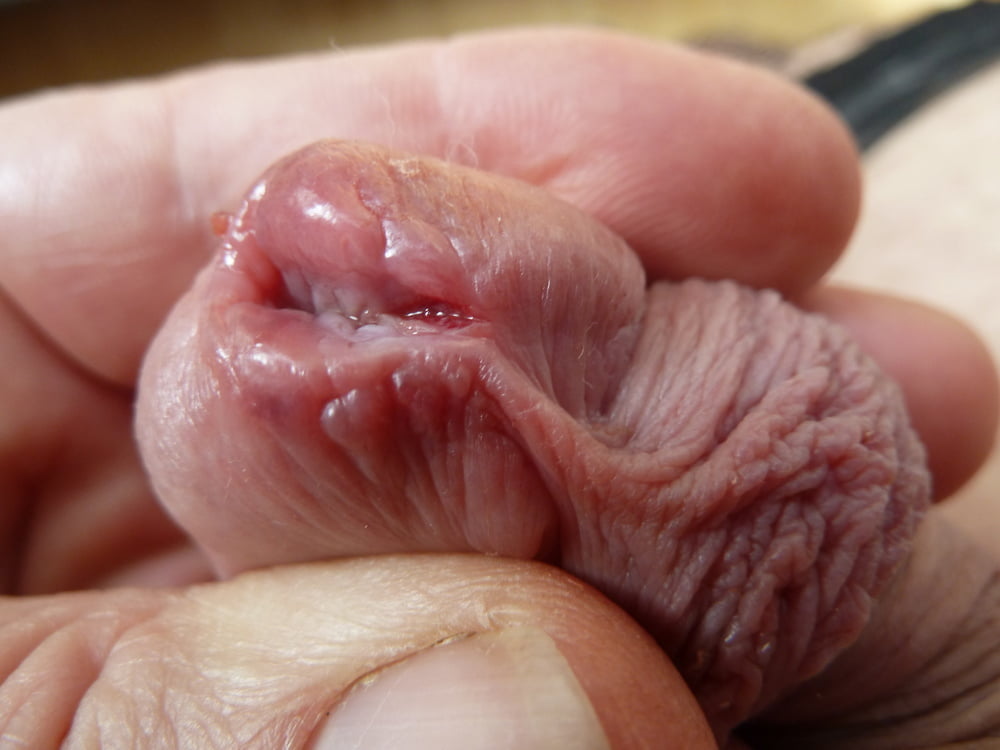 from a small to a big peehole #107224803