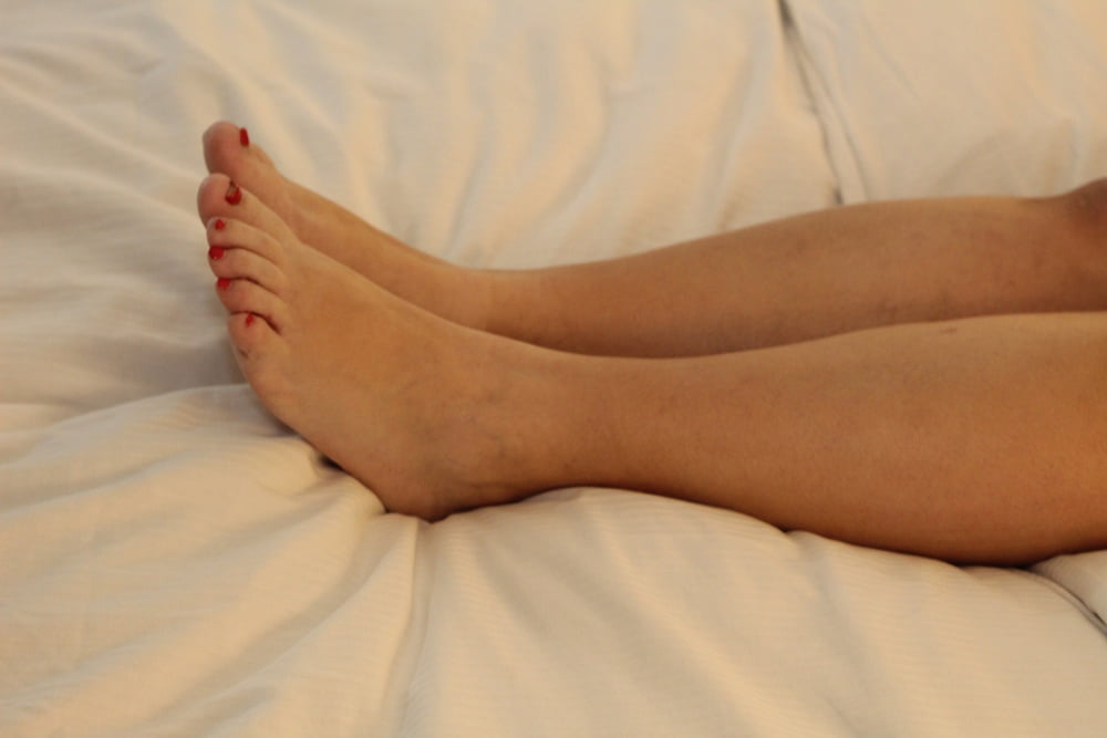 Feet photos #80339618