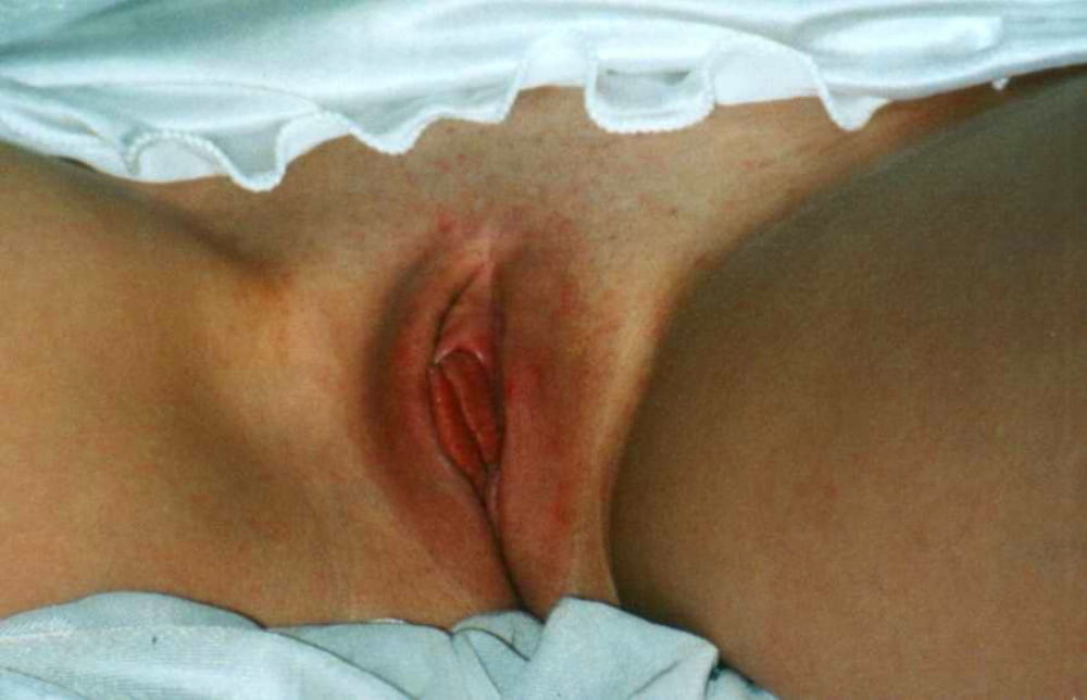 Maravillosa madura (25)
 #80590366