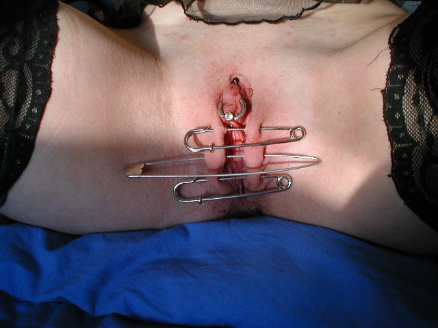 needles in tits, safety pins... #87881788