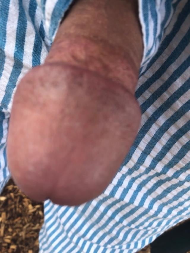 My small cock outdoors #92354901