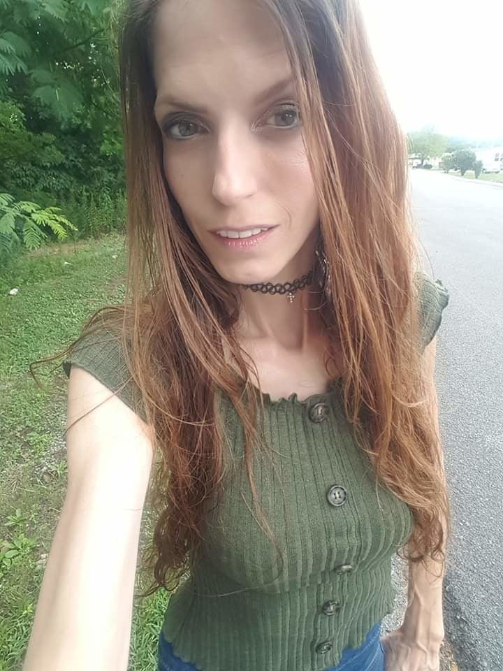 Post Transition pictures of me. #93926255