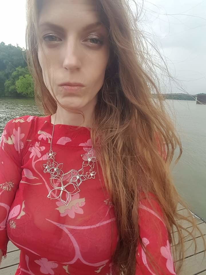 Post Transition pictures of me. #93926276