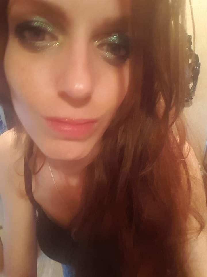 Post Transition pictures of me. #93926279