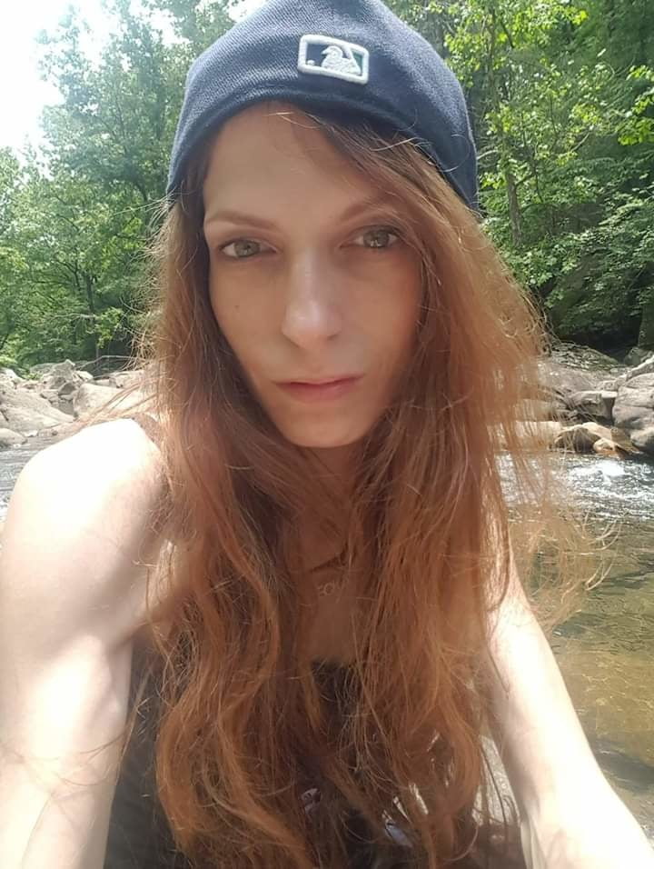 Post Transition pictures of me. #93926282