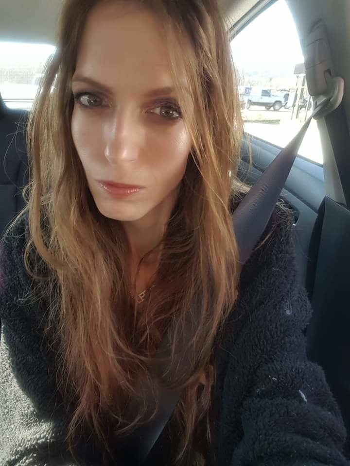 Post Transition pictures of me. #93926304