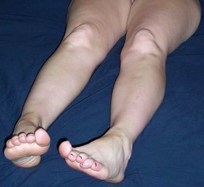 FEET #100318746