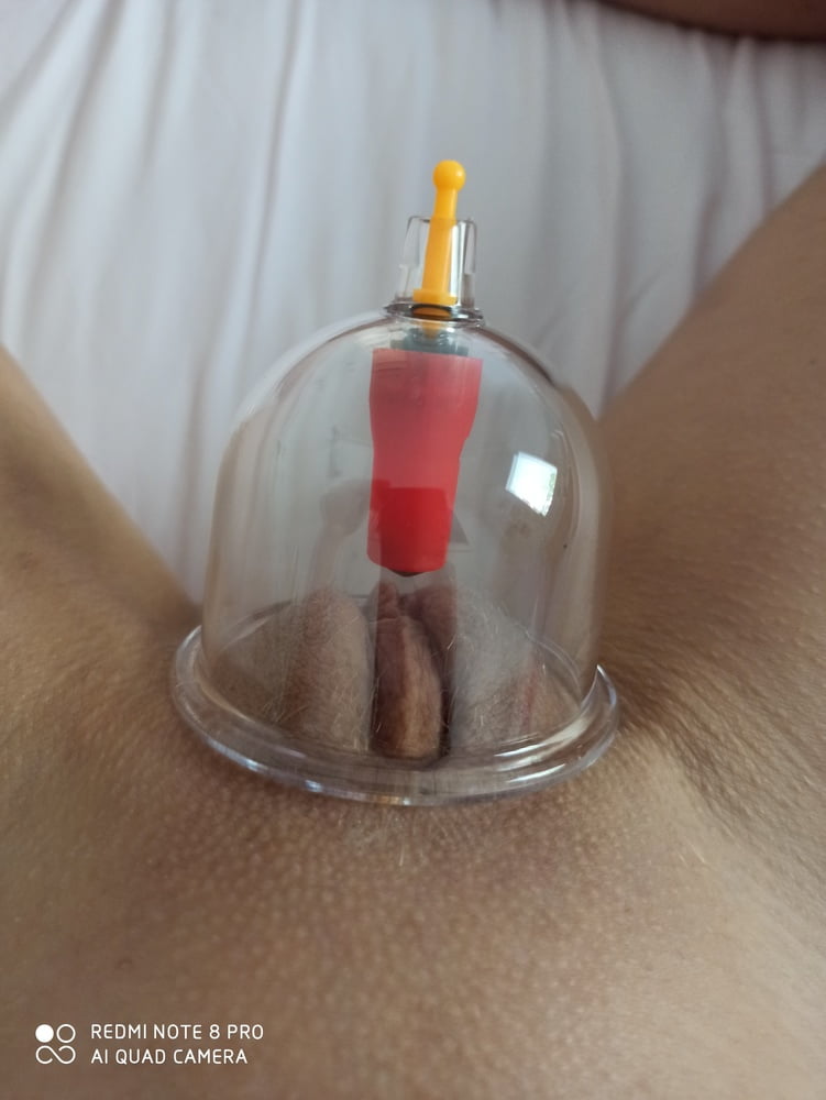 Cupping #97479119