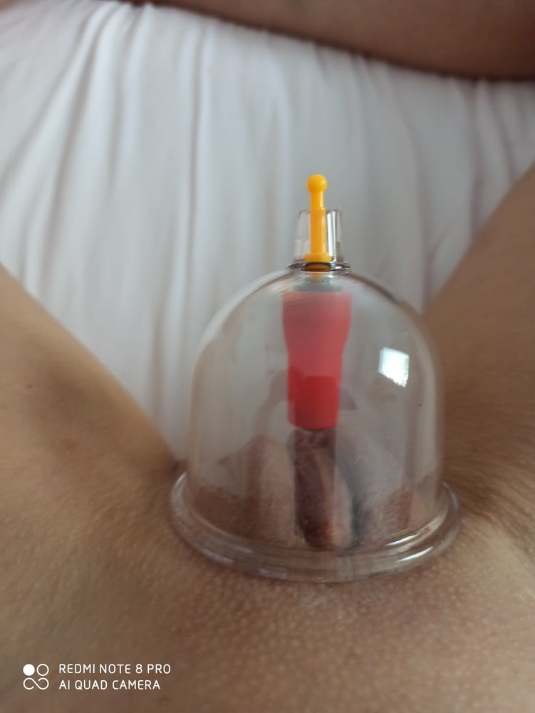Cupping #97479140