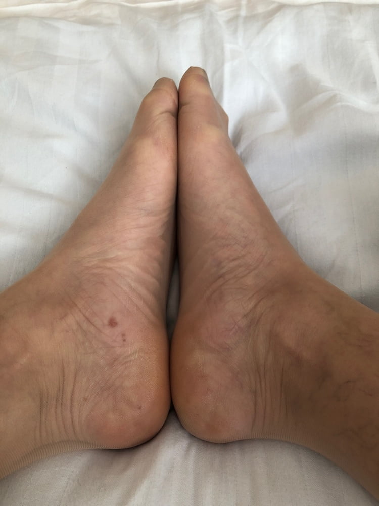 ナイロンフィート3
 #93607843