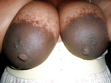Areolas grandes
 #89056124