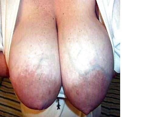Areolas grandes
 #89056127