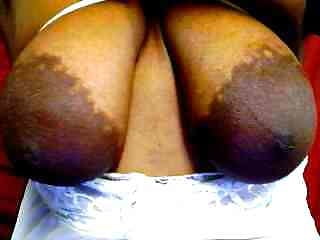 Areolas grandes
 #89056133