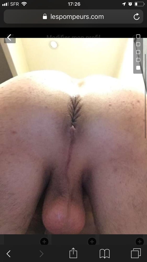 Mi BI bottom side #102520401