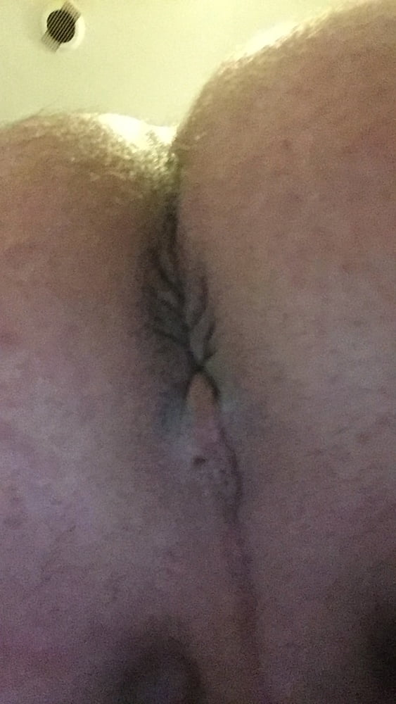 Mi BI bottom side #102520410