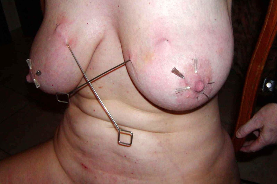 Needles #103222784