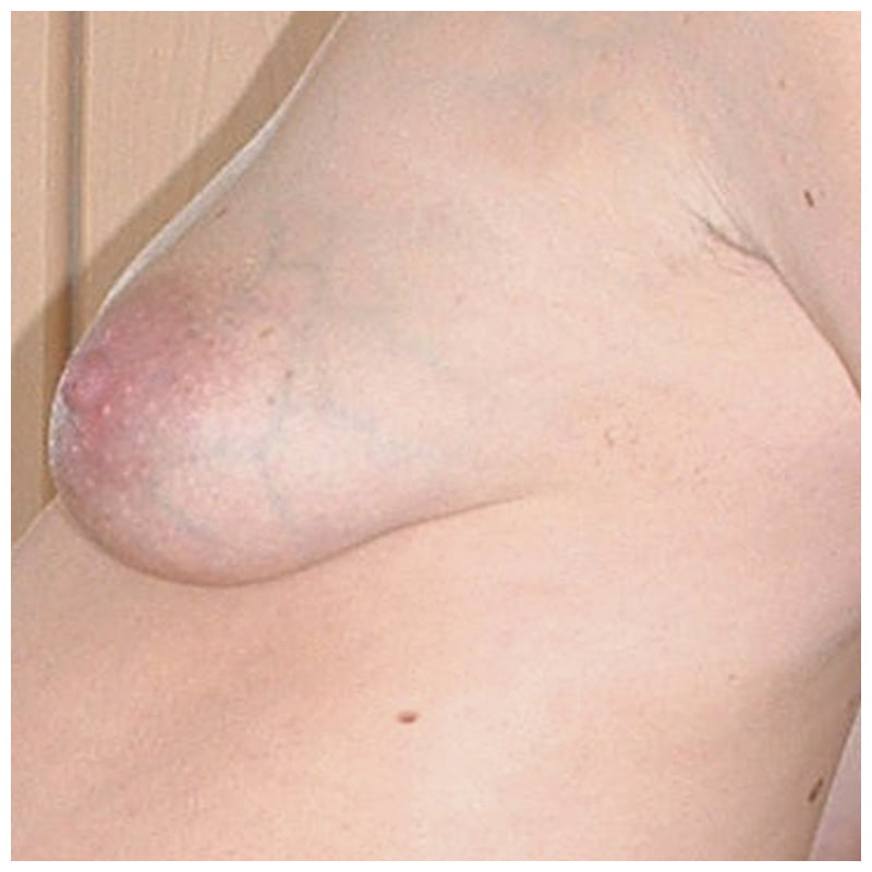 preg 10 #89291720