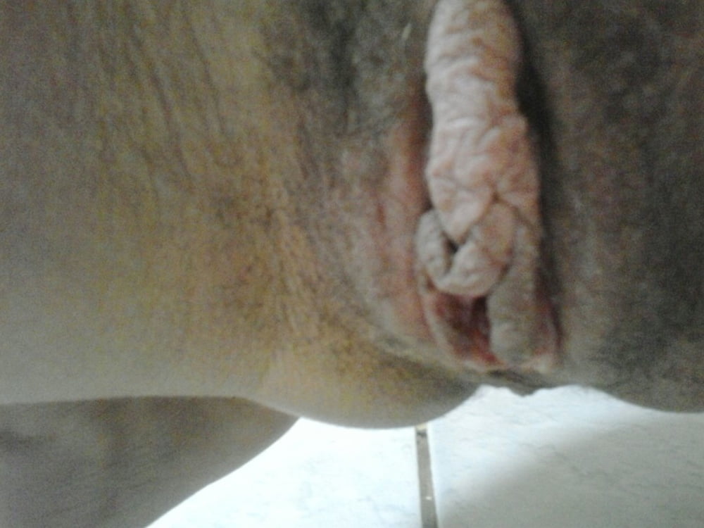 Coroa #97011742