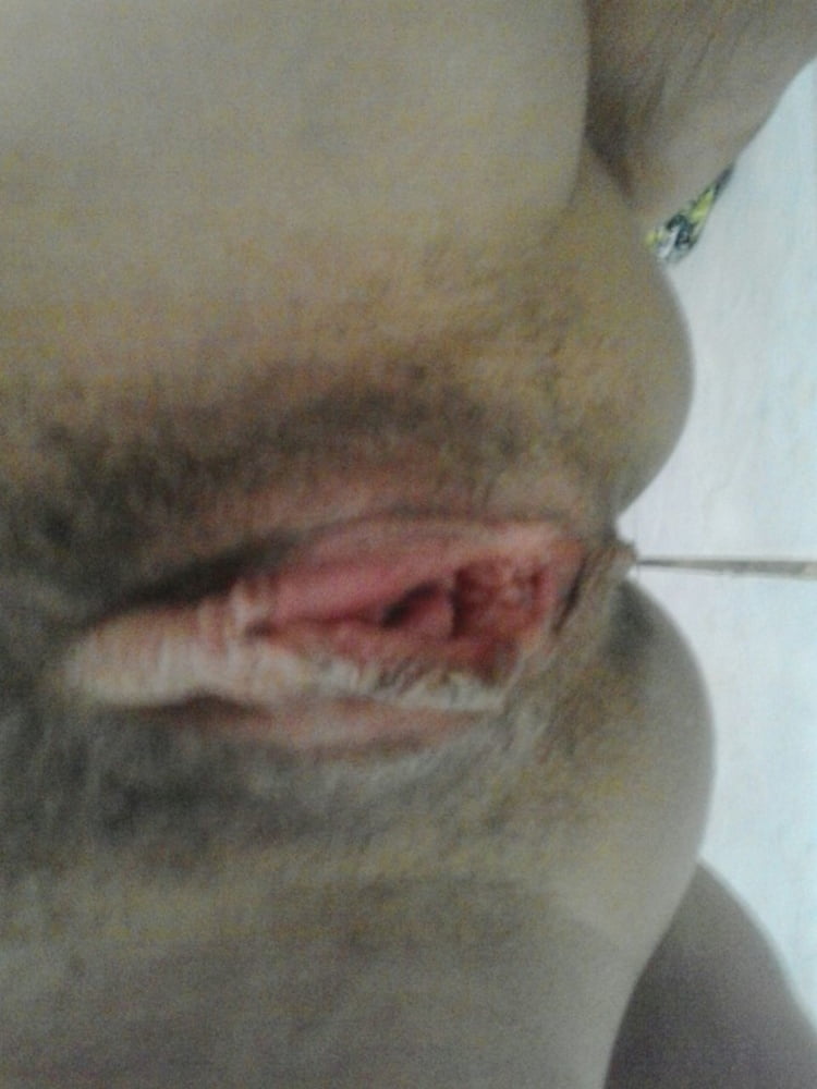 Coroa #97011774