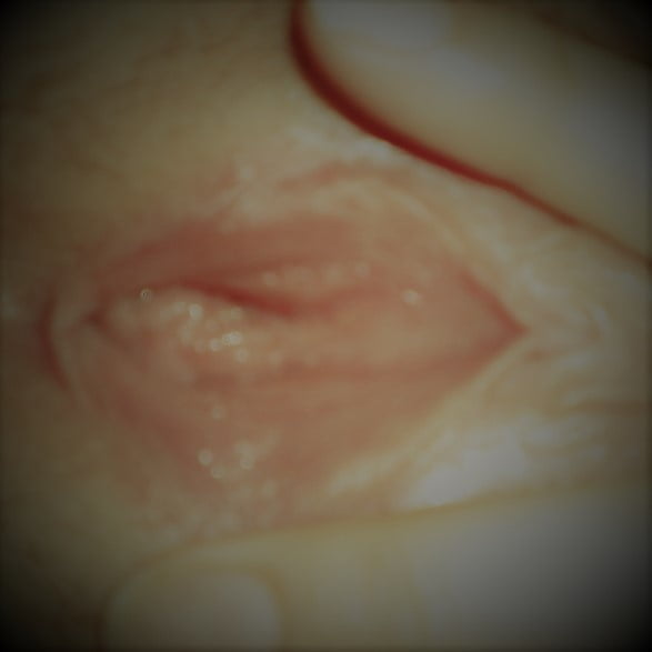 elkewet #102944670