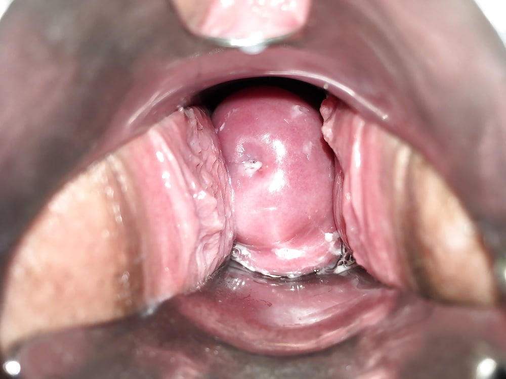 Cervix #106974031