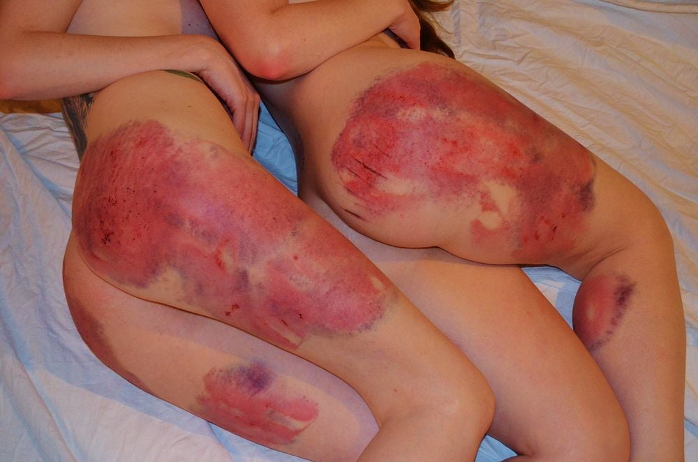 マーキングされた女の子
 #94863780