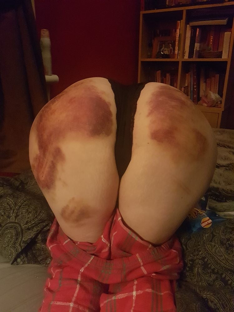 マーキングされた女の子
 #94863781