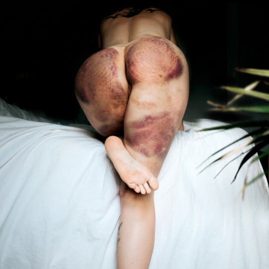 マーキングされた女の子
 #94863789