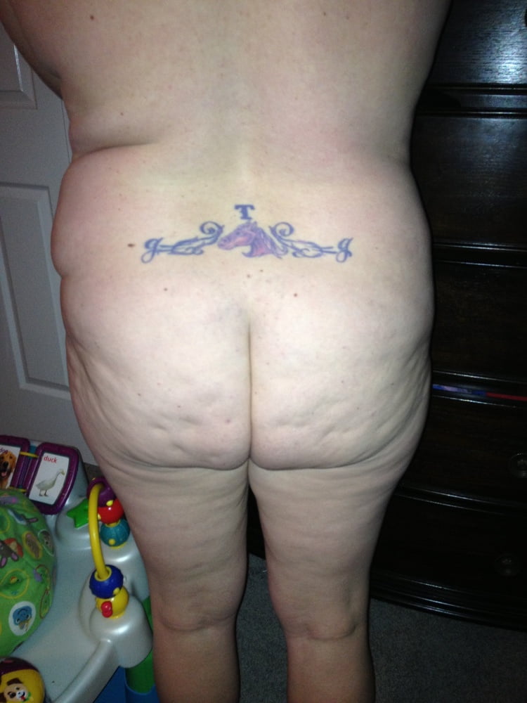 Best cellulite bums 4 #97618669
