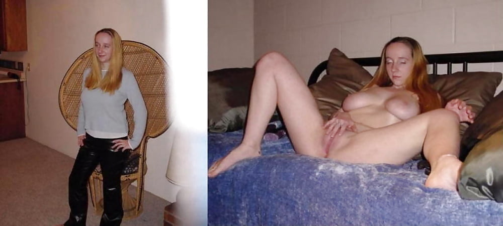 BEFORE AFTER 21 #100406048