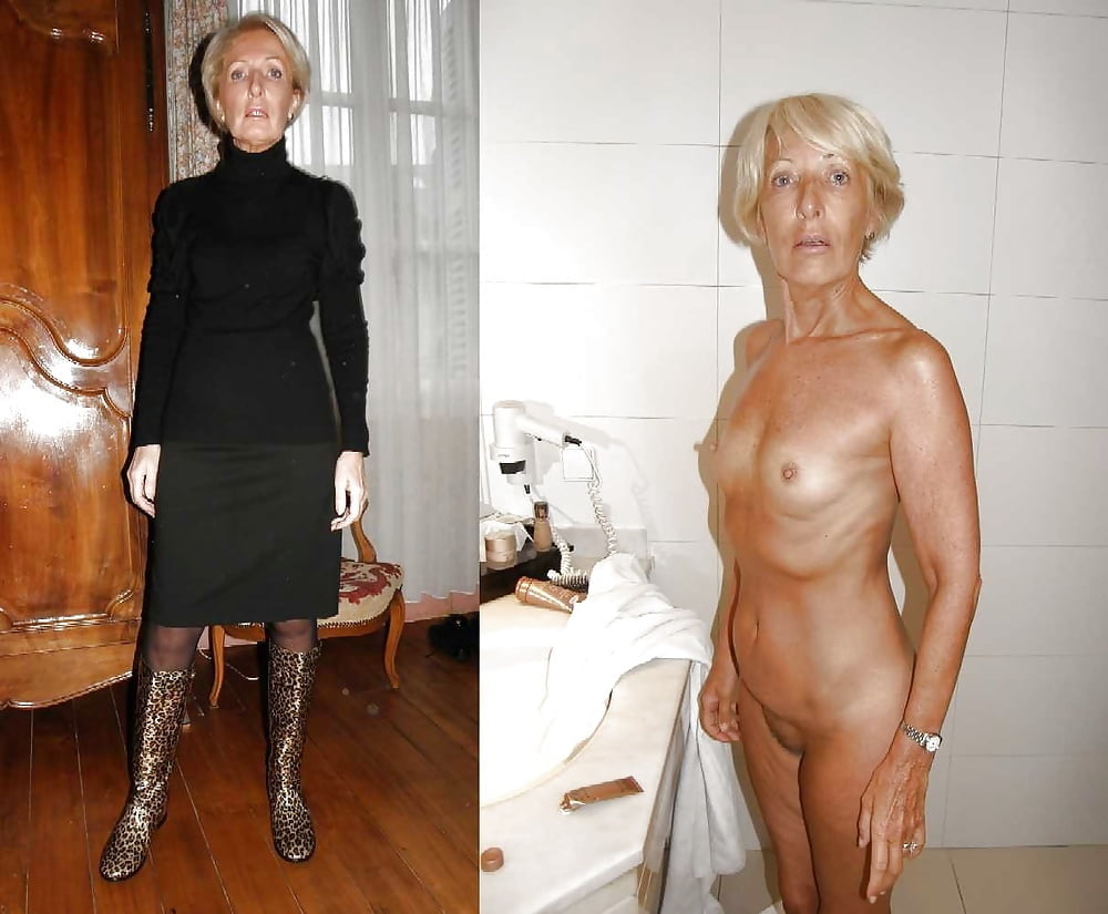 BEFORE AFTER 21 #100406074
