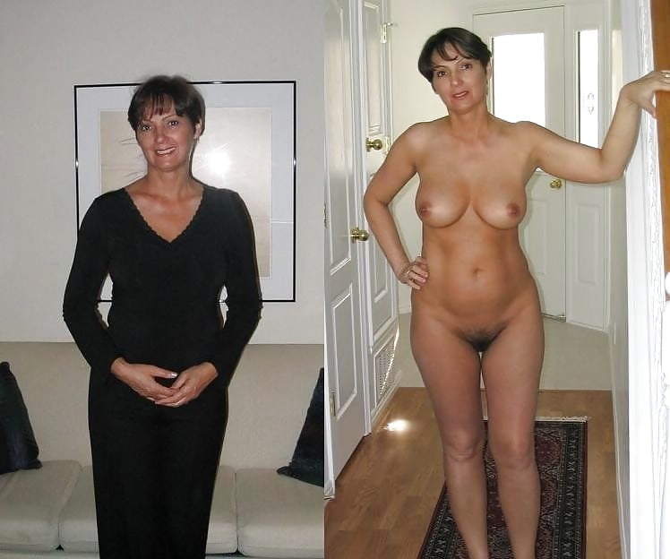 BEFORE AFTER 21 #100406075