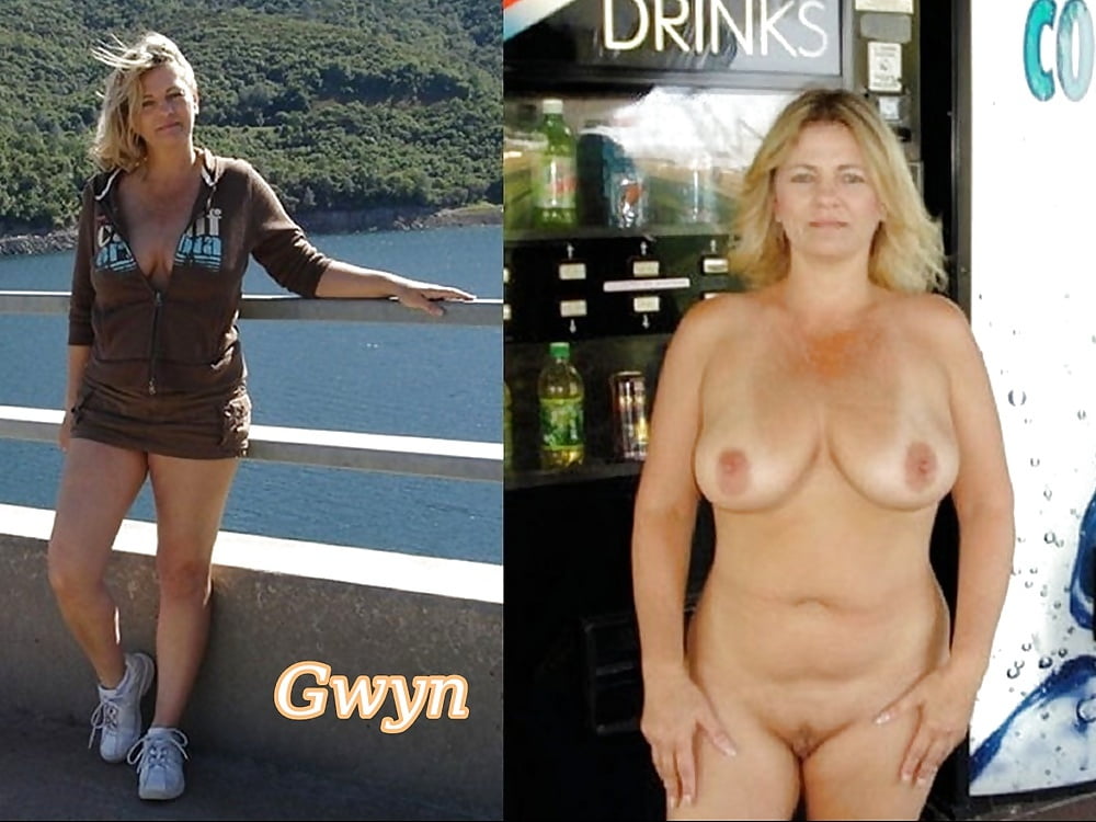 BEFORE AFTER 21 #100406156
