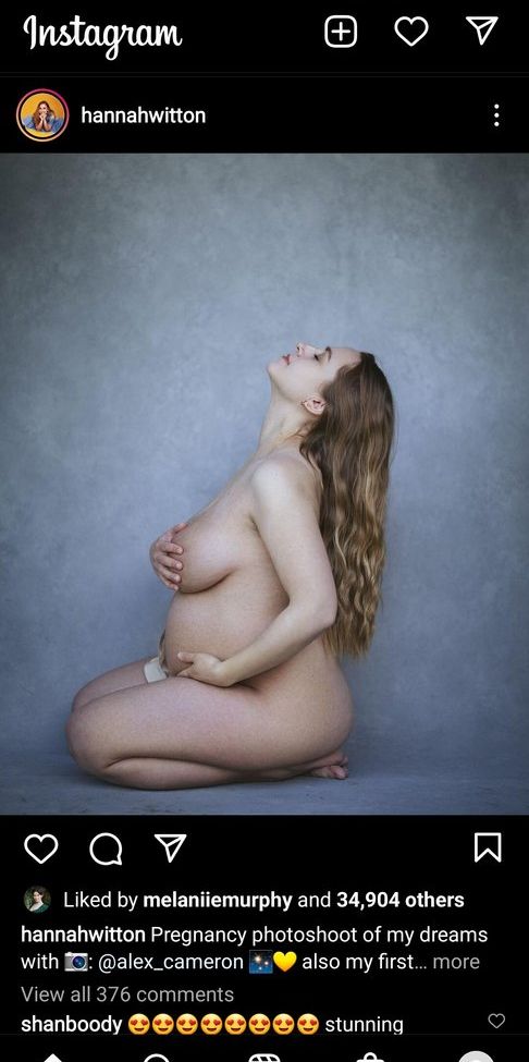 Hannah Witton desnuda #108757696