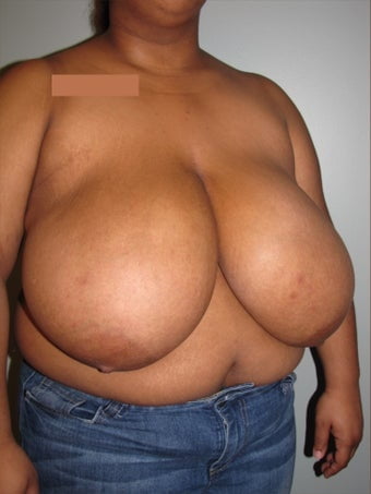 Tit n add medley
 #96890715