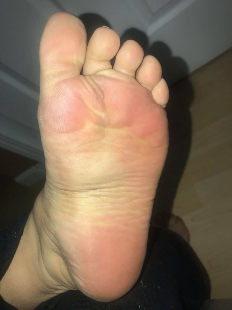 25 year old BBW mexican Soles Nut draining wrinkles #97818049